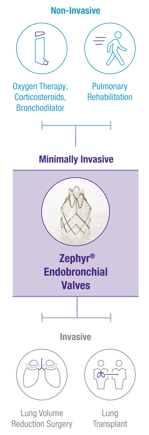 Treatment Options Severe Emphysema COPD